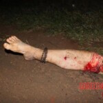 Cyclist lost both legs and his life in collision with car