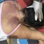 Depressed woman committed suicide