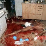 Dude cut off his own penis and bled to death