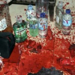 Dude cut off his own penis and bled to death