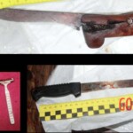 Dude cut off his own penis and bled to death