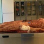 Dude cut off his own penis and bled to death