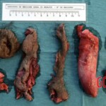 Dude cut off his own penis and bled to death