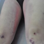 Examination of dead Chinese woman