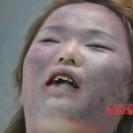 Examination of dead Chinese woman