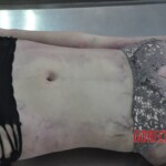 Examination of dead Chinese woman