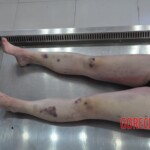 Examination of dead Chinese woman