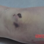 Examination of dead Chinese woman