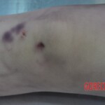 Examination of dead Chinese woman