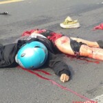 Fetus ejected from mother during motorcycle accident