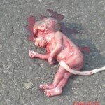 Fetus ejected from mother during motorcycle accident