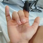 Girl tore off her finger while climbing over fence