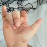 Girl tore off her finger while climbing over fence