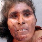Dead Indian woman