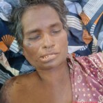 Dead Indian woman