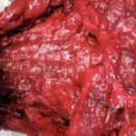 Man died after ingesting poisonous root