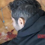 Man died after ingesting poisonous root