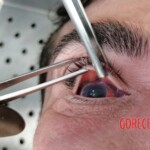 Man died after ingesting poisonous root