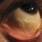 Parasite in eye after mosquito bite