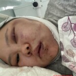 Russian woman beaten by her drunken husband