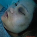 Russian woman beaten by her drunken husband