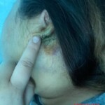 Russian woman beaten by her drunken husband