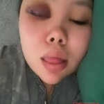 Russian woman beaten by her drunken husband