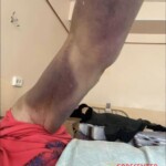 Russian woman nearly tortured her mother to death