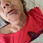 Russian woman nearly tortured her mother to death