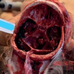 Stabbed to death by her partner