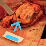 Stabbed to death by her partner