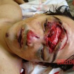 Suicide jumper after impact from skyscraper rooftop