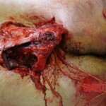 Suicide jumper after impact from skyscraper rooftop