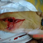 Suicide jumper after impact from skyscraper rooftop