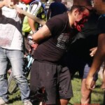 Thief shot in jaw with shotgun