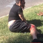 Thief shot in jaw with shotgun