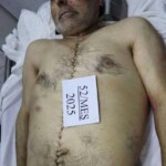 Two Azerbaijani brothers killed during police raid in Russia