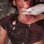 Two young Cambodian women crushed by truck