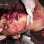 Two young Cambodian women crushed by truck