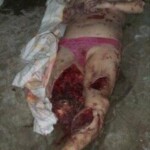 Ukrainian woman hit by mortar