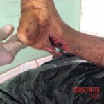 Edilson Rodrigues da Silva