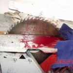 Woman committed suicide with circular saw