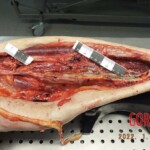 Woman suddenly died of cardiac arrest caused by venous thrombosis