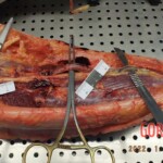 Woman suddenly died of cardiac arrest caused by venous thrombosis