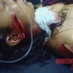 Woman survives machete attack by her husband