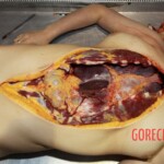 Autopsy of Chinese woman found dead on hotel bed