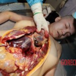 Autopsy of Chinese woman found dead on hotel bed