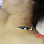 Autopsy of Chinese woman found dead on hotel bed