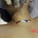 Autopsy of Chinese woman found dead on hotel bed