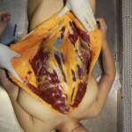 Autopsy of Chinese woman found dead on hotel bed